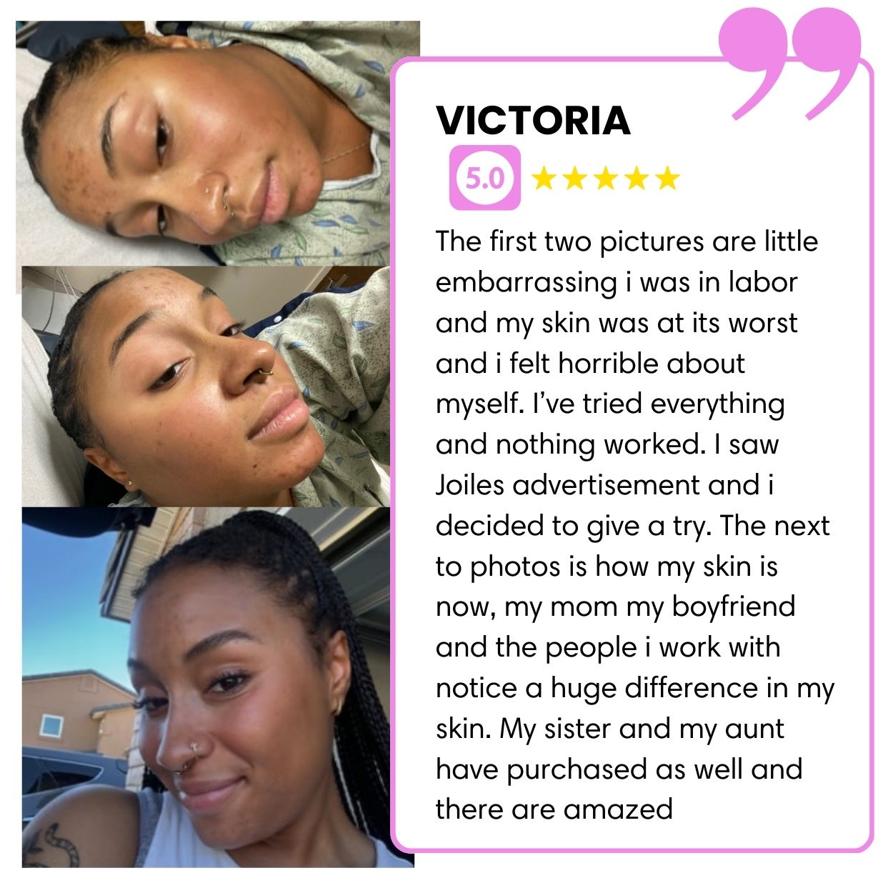 BIGGER EDITION: Jolie’s Full Body & Face Brightening / Acne Kit