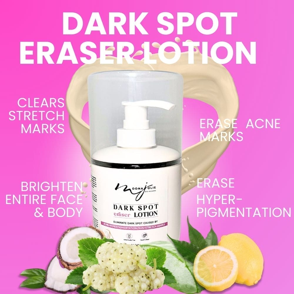 BIGGER EDITION: Jolie’s Full Body & Face Brightening / Acne Kit