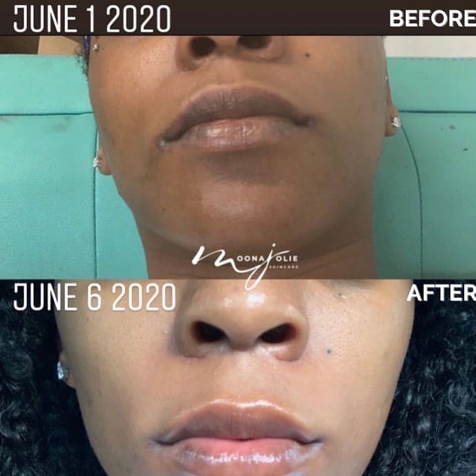 Jolie Lip Brightening Cream