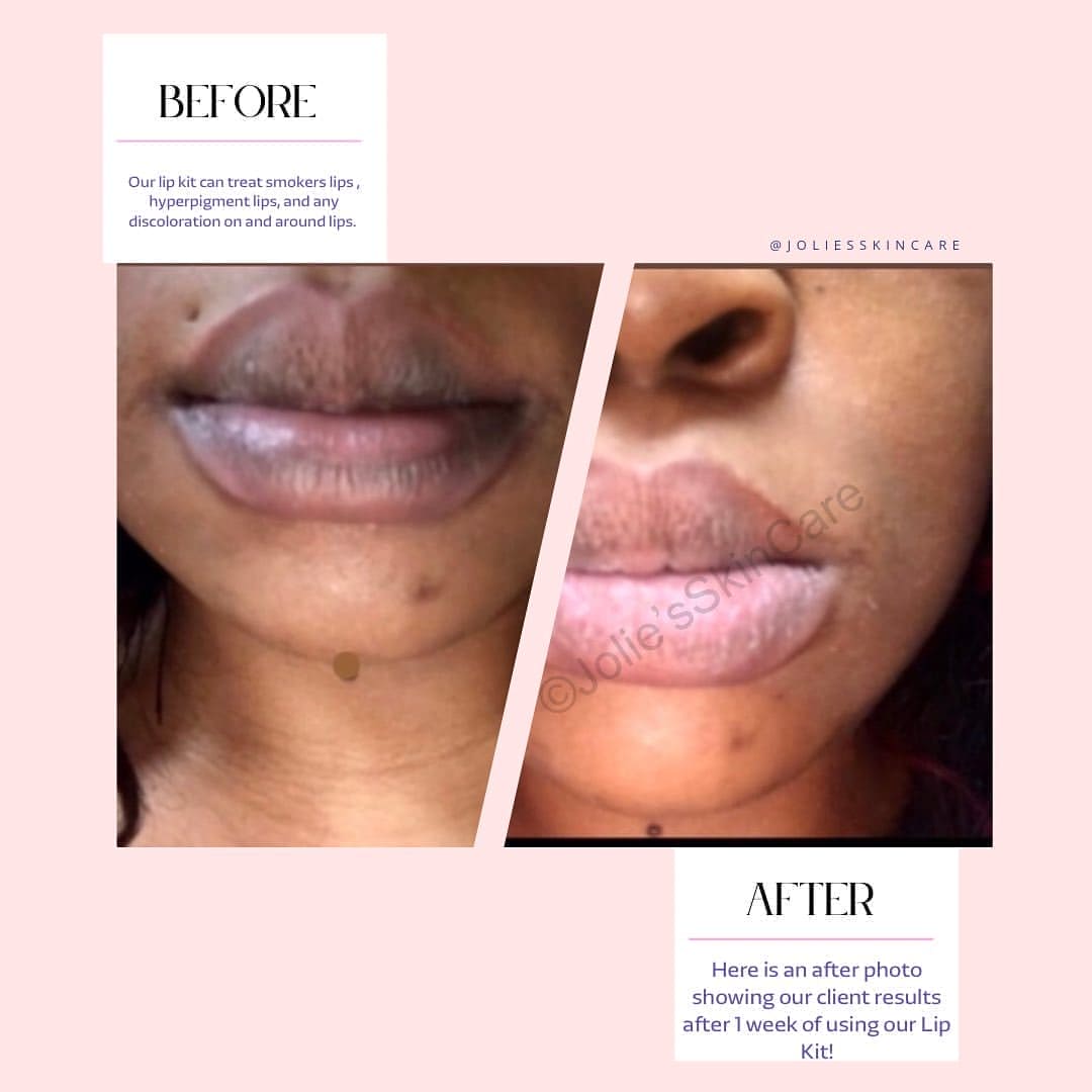 Jolie Lip Brightening Cream