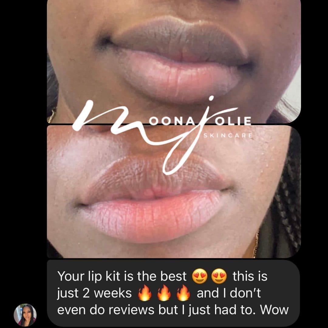 Jolie Lip Brightening Cream