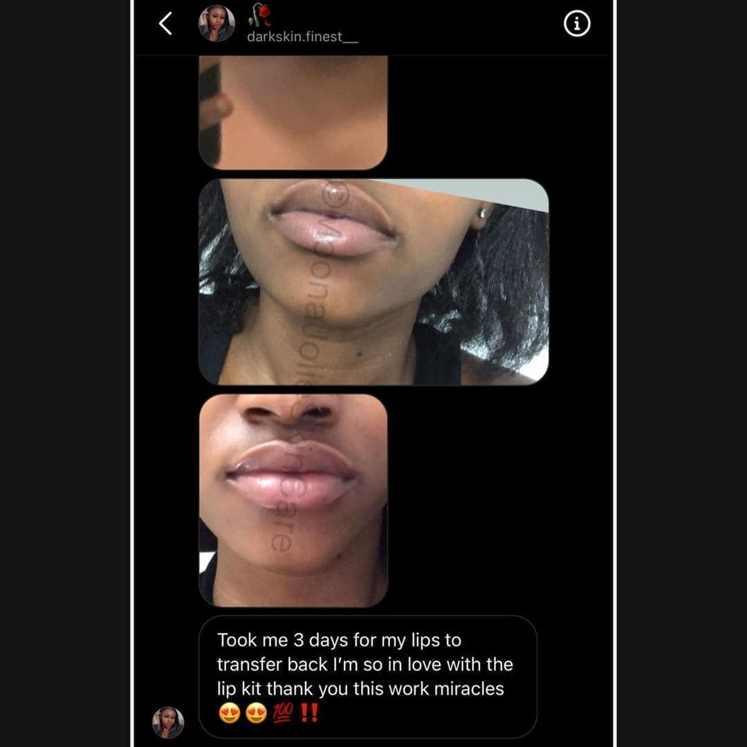 Jolie Lip Brightening Cream