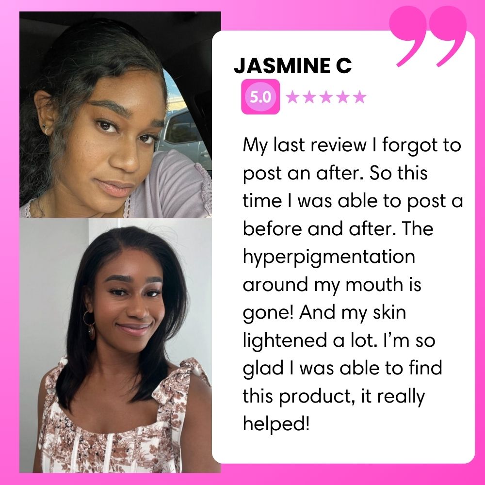 BIGGER EDITION: Jolie’s Full Body & Face Brightening / Acne Kit