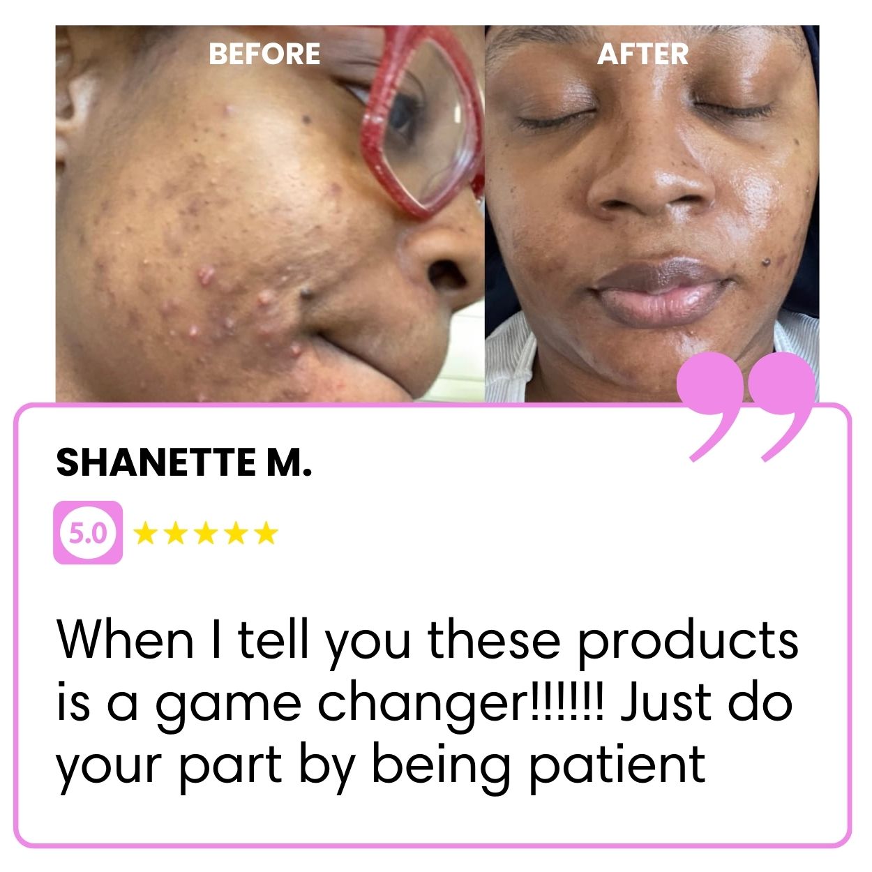 BIGGER EDITION: Jolie’s Full Body & Face Brightening / Acne Kit