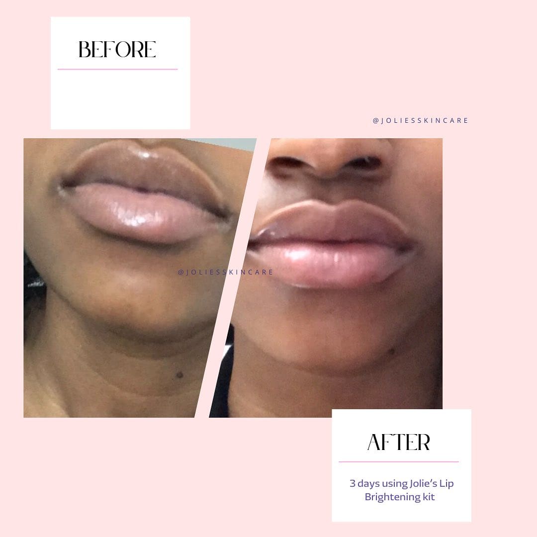 Jolie’s Lip Kit