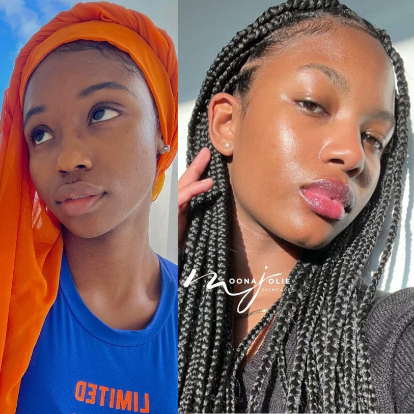 BIGGER EDITION: Jolie’s Full Body & Face Brightening / Acne Kit
