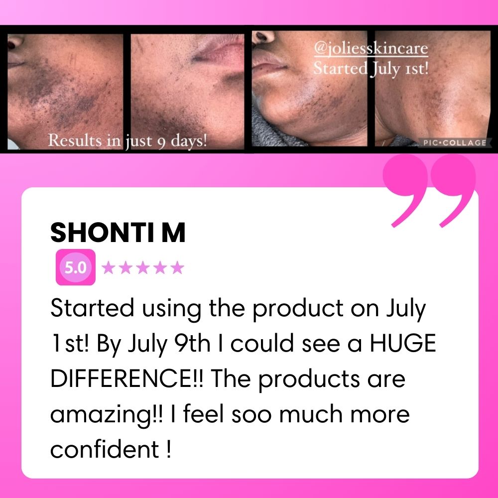 BIGGER EDITION: Jolie’s Full Body & Face Brightening / Acne Kit