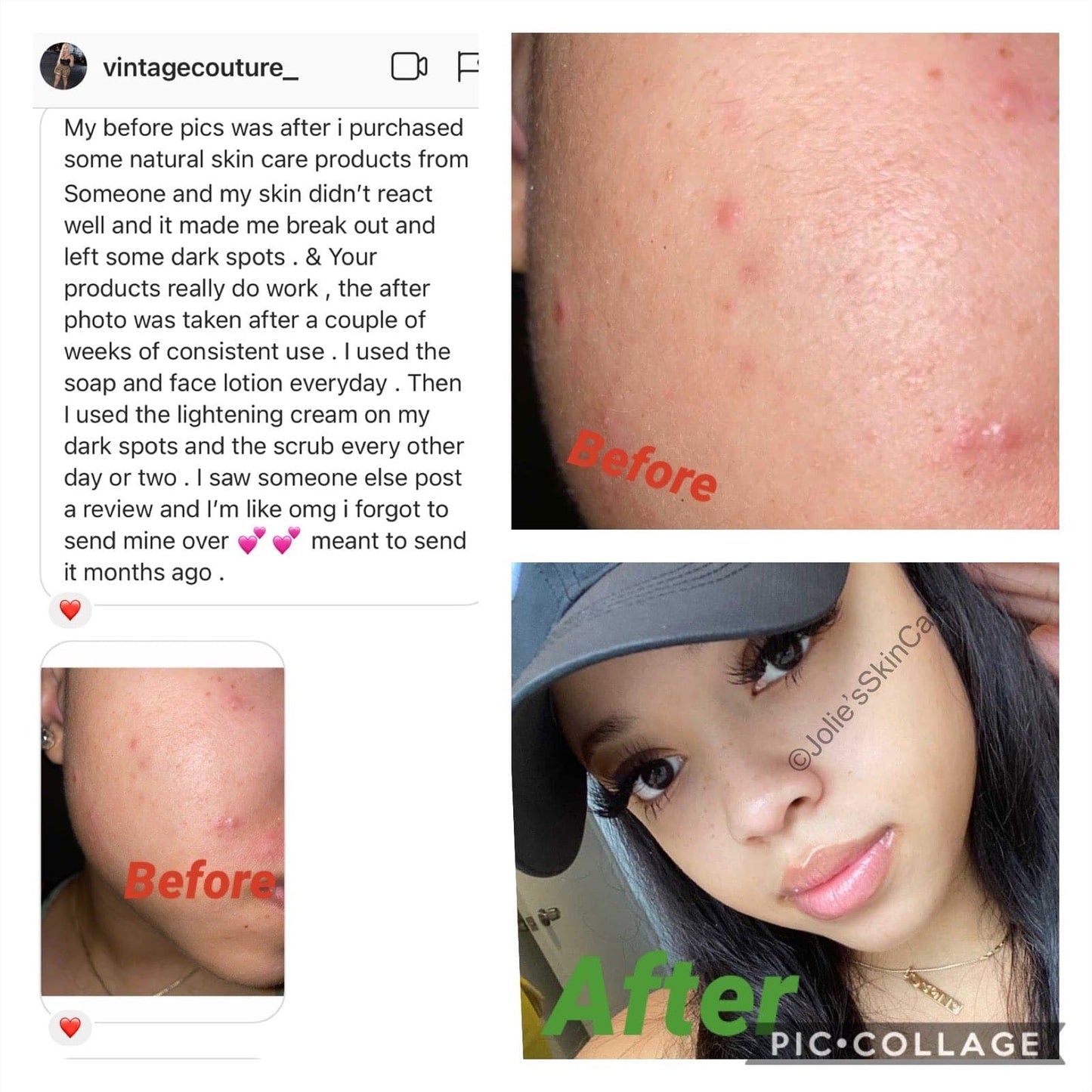 Jolie’s Full Body & Face Brightening Kit